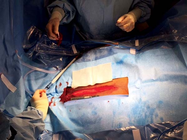 Equine abdominal surgery – nursing theatre essentials