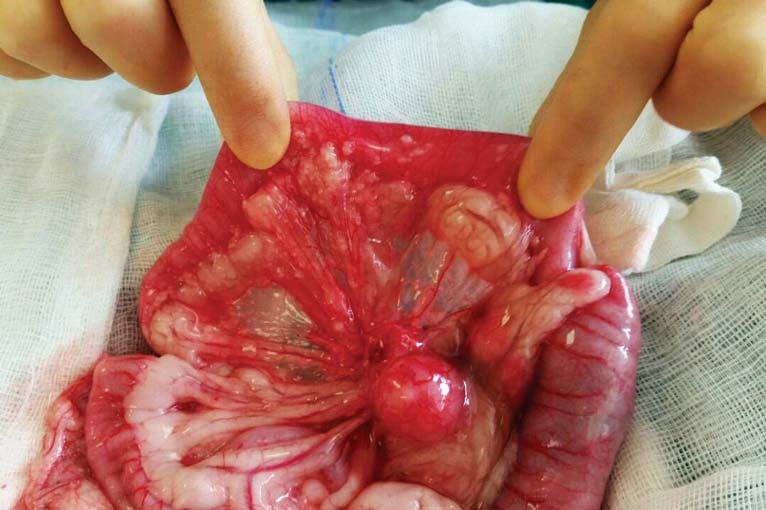 Low-grade alimentary lymphoma