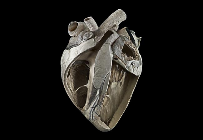 &#8216;Artistic&#8217; bovine heart photo shortlisted for awards