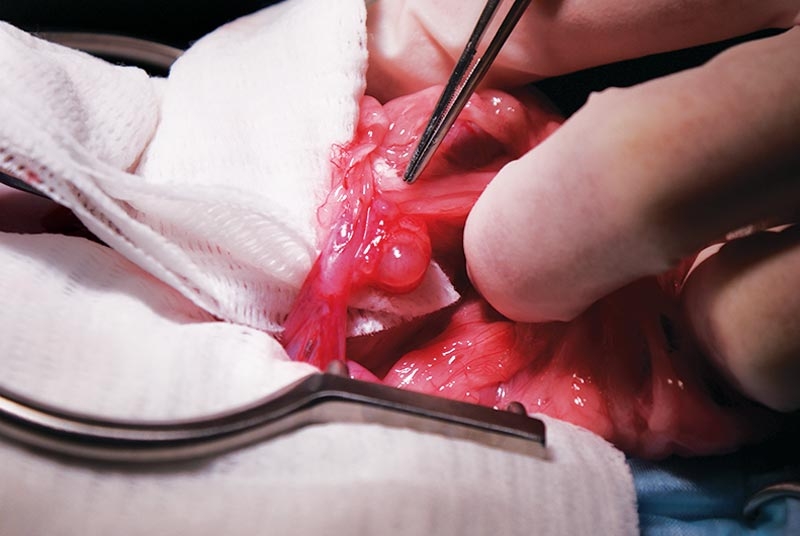 Diagnosis and treatment of ovarian remnant syndrome
