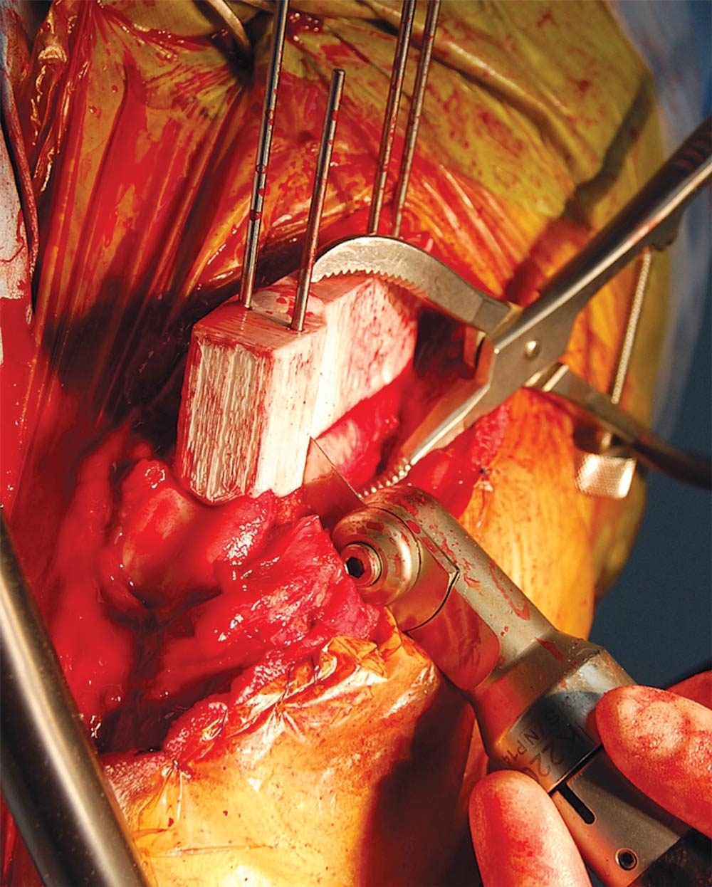 Concepts in managing canine medial patellar luxation cases