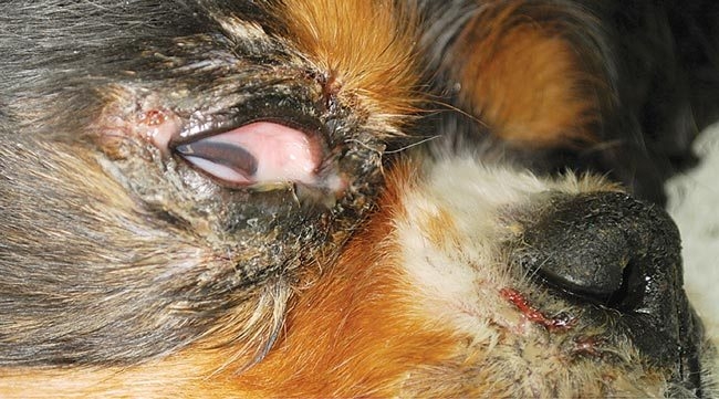Superficial necrolytic dermatitis