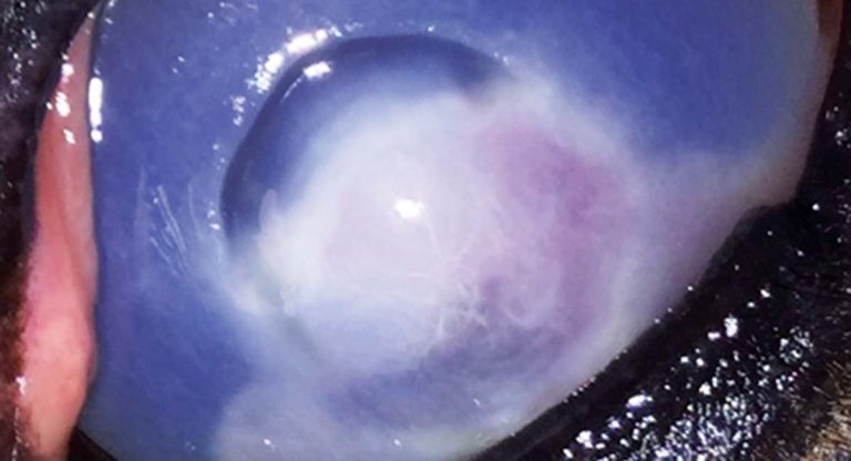 Non-healing corneal ulcers