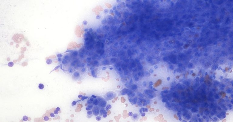 Tail mass in a mixed breed dog