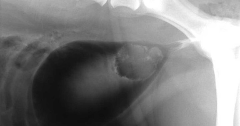 Evaluating haematuria and dysuria via urine cytology