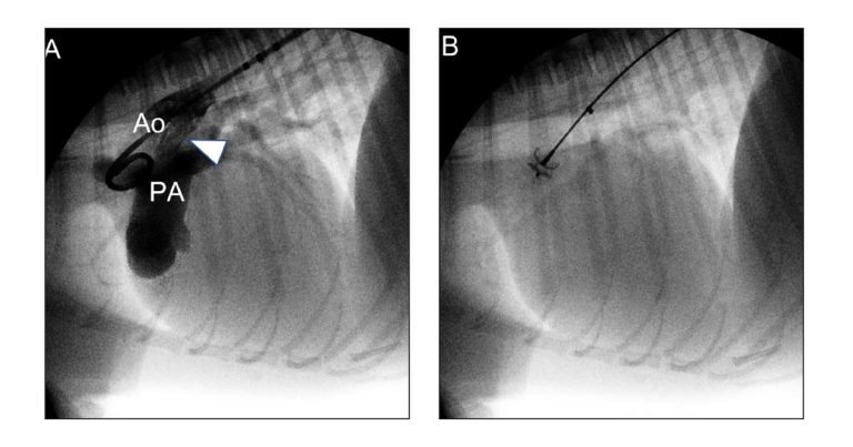 Interventional cardiology – definition, usage and role