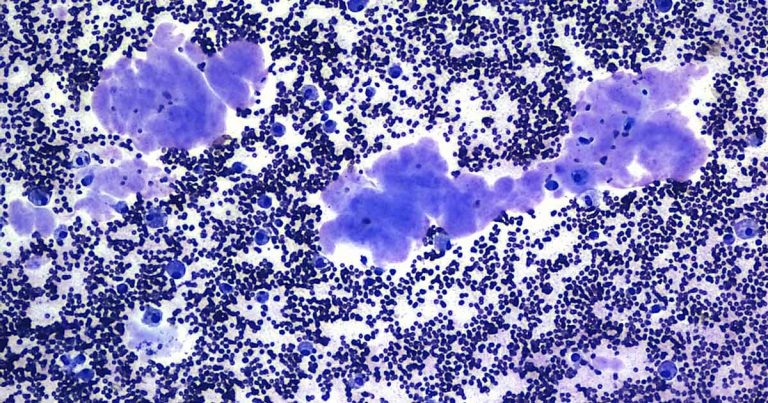 Cytology findings from a neck swelling in a German shepherd dog