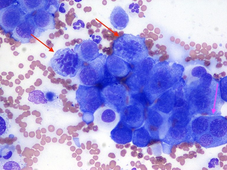 Pleural effusion from a cat