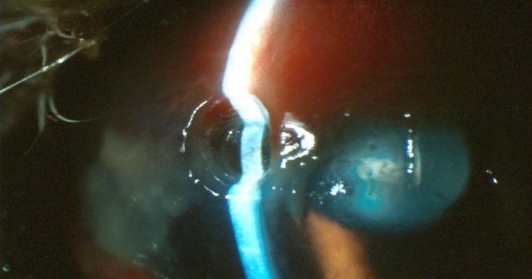 Corneal ulcers in cats
